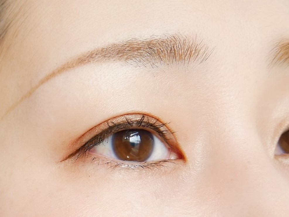 リッドキララは伸びた瞼に効果ある？